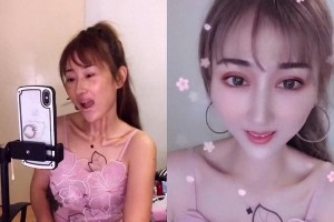 明星整容前后对比：赵露思、于适、华晨宇判若两人